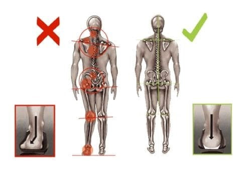 Vložki po meri - FizioLoMM